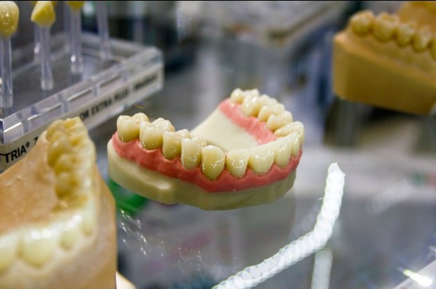 Full-arch dental prosthesis on a working model in a dental laboratory
