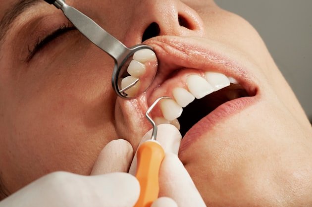 Dentist examining a patient with a mouth mirror and probe at the gumline